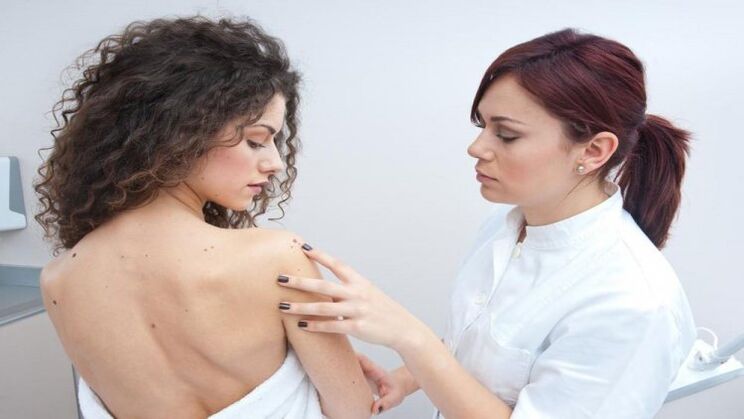 Ο γιατρός εξετάζει το θηλώμα στο δέρμα